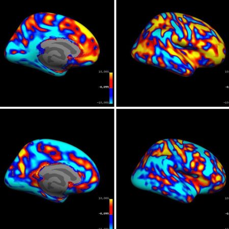 Studi sul cervello